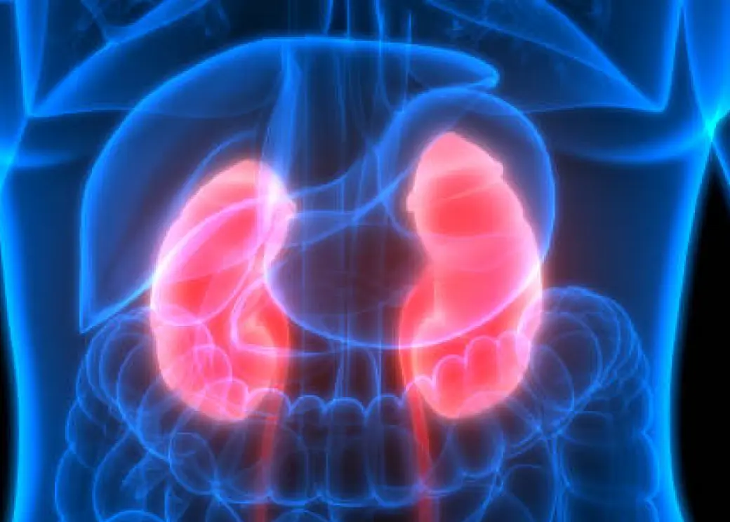 tumores renias e cancer de rim